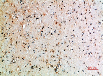 CD152 rabbit pAb Antibody
