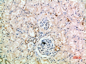 CD218b rabbit pAb Antibody