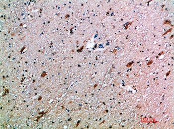 CD314 rabbit pAb Antibody