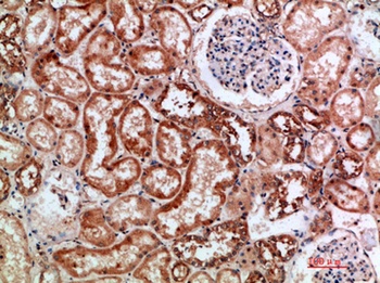 BTN3A1/2/3 rabbit pAb Antibody