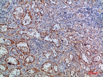 LT-β rabbit pAb Antibody