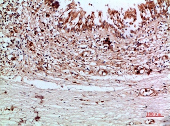 Thyroglobulin rabbit pAb Antibody