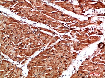 TTN rabbit pAb Antibody
