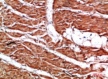 TTN rabbit pAb Antibody