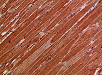 TTN rabbit pAb Antibody