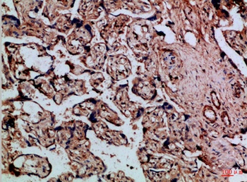 Cystatin B rabbit pAb Antibody