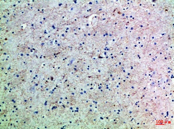 Ob rabbit pAb Antibody