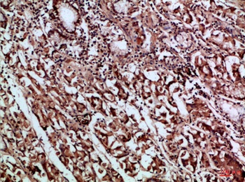 CD66a/b/c rabbit pAb Antibody