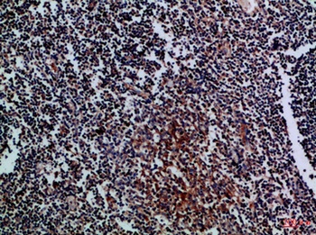 CD70 rabbit pAb Antibody