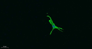 CD274 rabbit pAb Antibody
