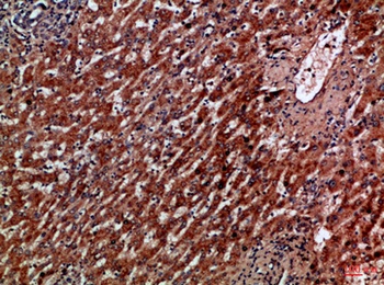 IL-8RA rabbit pAb Antibody