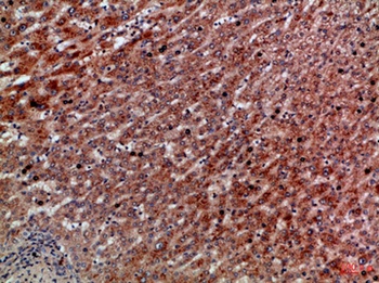 IL-8RA rabbit pAb Antibody