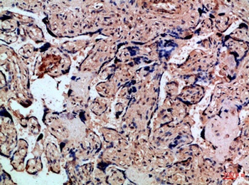IL-8RA rabbit pAb Antibody