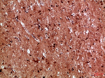 IL-17D rabbit pAb Antibody