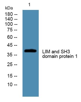 LIM and SH3 domain protein 1 rabbit pAb Antibody
