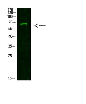 NUT rabbit pAb Antibody