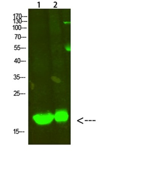 MYL2 rabbit pAb Antibody