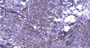 MYL2 rabbit pAb Antibody