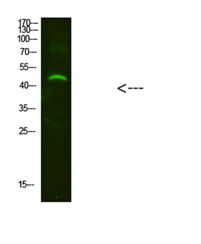 NMUR2 rabbit pAb Antibody
