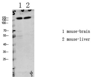 LATS1/2 (Phospho-Thr1079/1041) Rabbit pAb Antibody