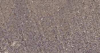 RIPK2 (Phospho-Ser176) Rabbit pAb Antibody