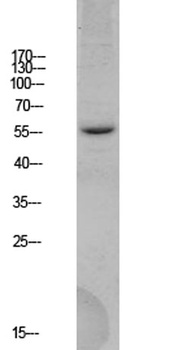 BACE rabbit pAb Antibody
