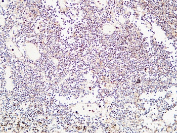 TIE2 rabbit pAb Antibody