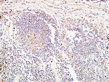 TIE2 rabbit pAb Antibody