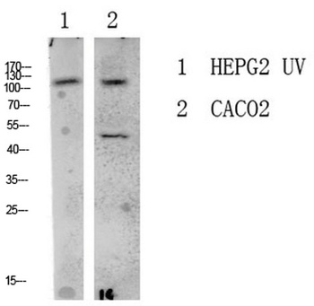 LATS1/2 Rabbit pAb Antibody