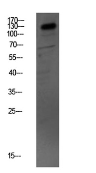 MYBPC3 rabbit pAb Antibody