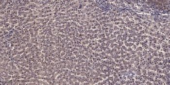 MYBPC3 rabbit pAb Antibody