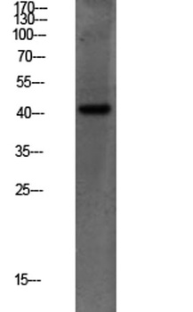 PEX14 rabbit pAb Antibody