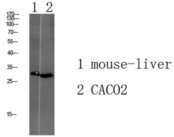 Tmem72 rabbit pAb Antibody