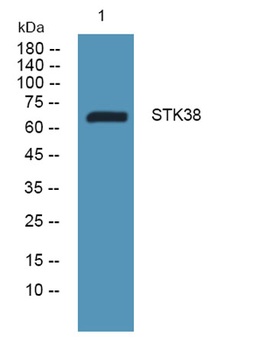 STK38 rabbit pAb Antibody