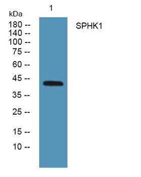 SPHK1 rabbit pAb Antibody