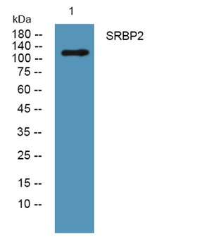 SRBP2 rabbit pAb Antibody