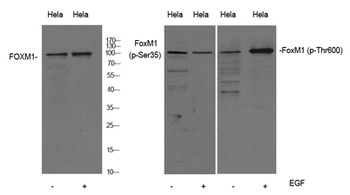 FOXM1 rabbit pAb Antibody