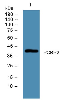PCBP2 rabbit pAb Antibody
