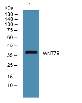 WNT7B rabbit pAb Antibody