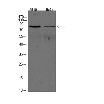 ADAM9 rabbit pAb Antibody