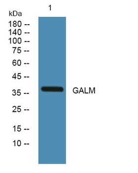 GALM rabbit pAb Antibody