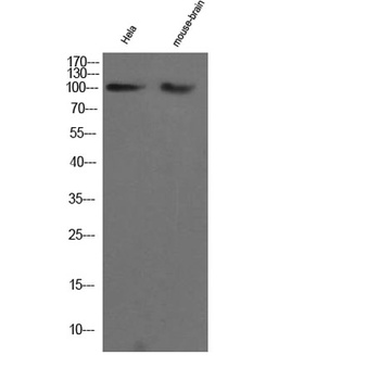 CHERP rabbit pAb Antibody