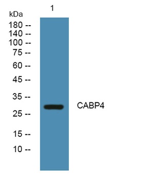 CABP4 rabbit pAb Antibody