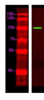 EDEM3 rabbit pAb Antibody