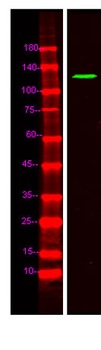FNBP4 rabbit pAb Antibody