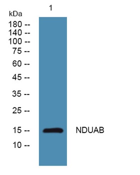 NDUAB rabbit pAb Antibody