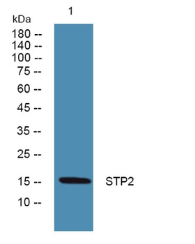 STP2 rabbit pAb Antibody