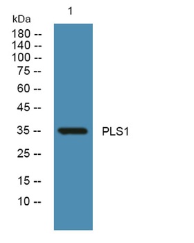 PLS1 rabbit pAb Antibody