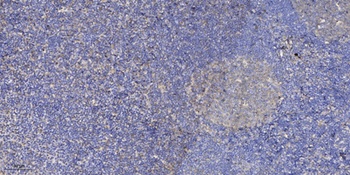 PLEC rabbit pAb Antibody