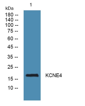 KCNE4 rabbit pAb Antibody
